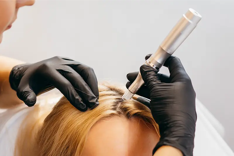 Dermatologia Capilar